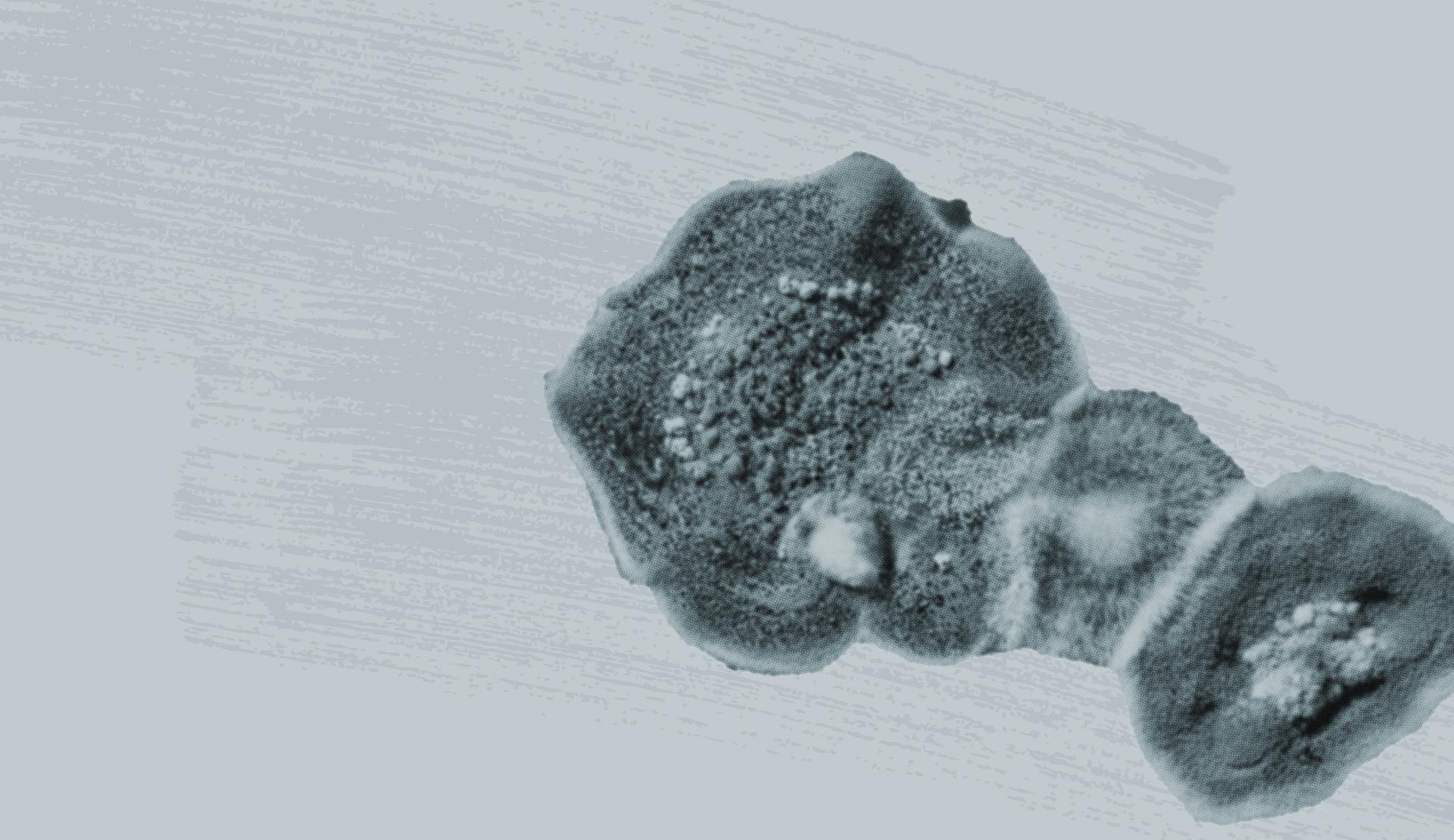 Schimmelanalyse
& Entfernung